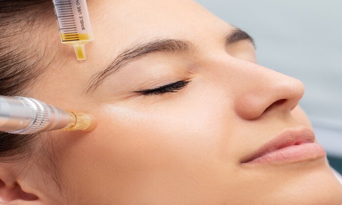 Why PRP Therapy is Gaining Popularity for Anti-Aging Treatments