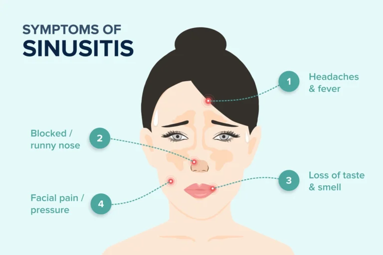 Sinus Pain: When to See an ENT for Relief