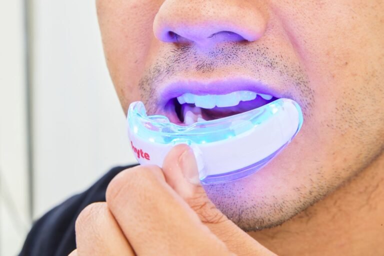 The Best Teeth Whitening Options for Sensitive Teeth