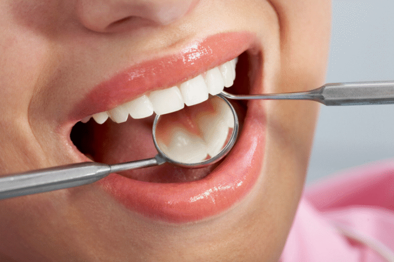 Teeth