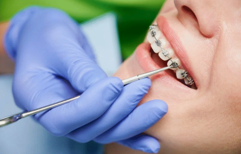 How Orthodontics Can Improve Oral Health And Function