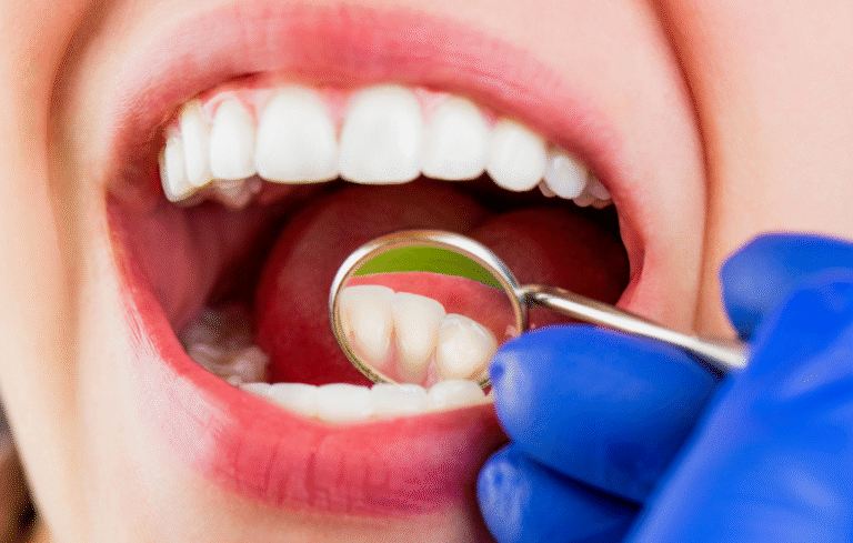 The Difference Between Cosmetic And Restorative Dental Treatments