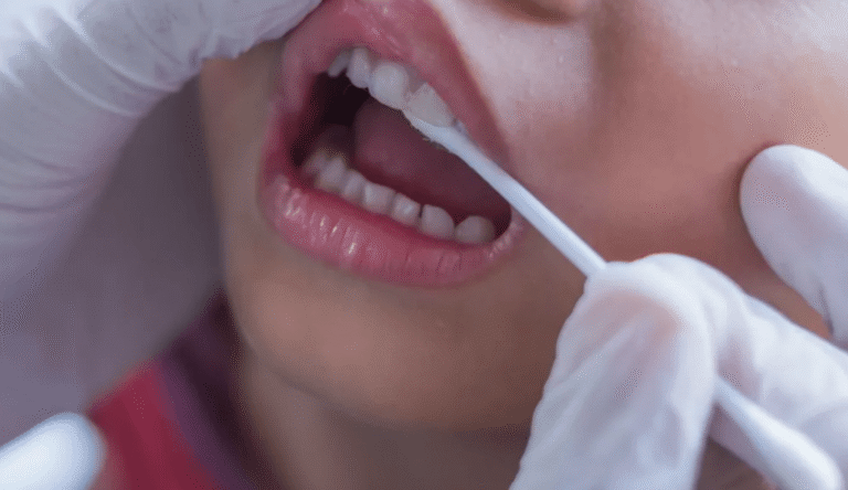 Fluoride Treatments And Sealants: Simple Solutions For Stronger Teeth