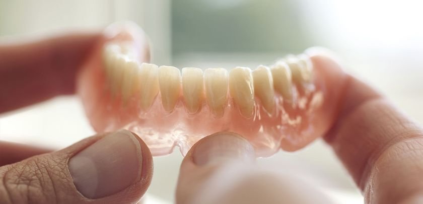 The Advantages Of Fixed Vs. Removable Dentures